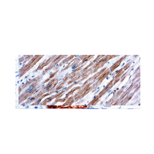 Actinin