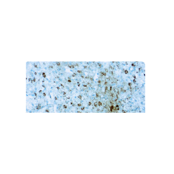 Anti-Isocitrate Dehydrogenase 1