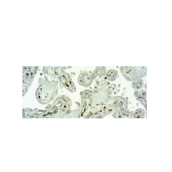 Caspase 1