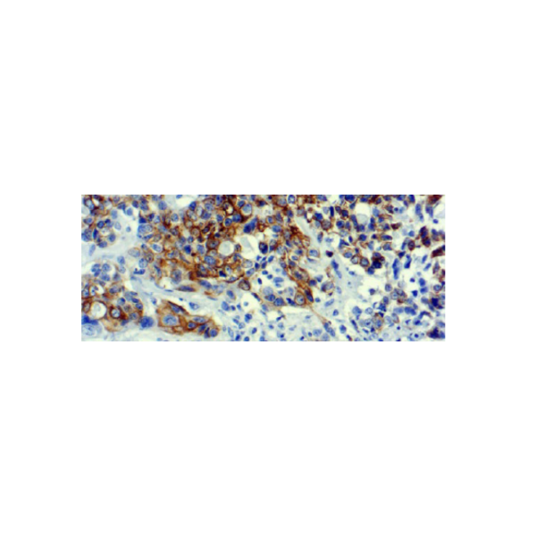 Cytokeratin 7 (LP1K)