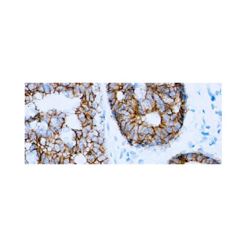 E-Cadherin