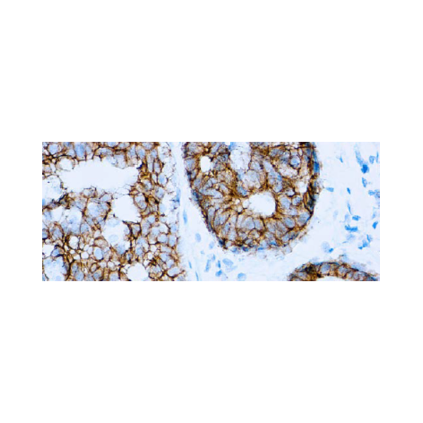 E-Cadherin