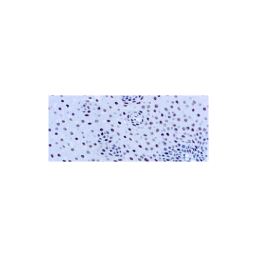 ERCC1