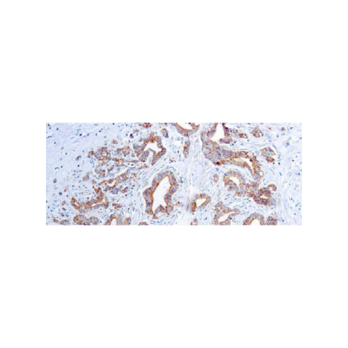 Factor de Crecimiento Endotelial Vascular (VEGF) (VG1)