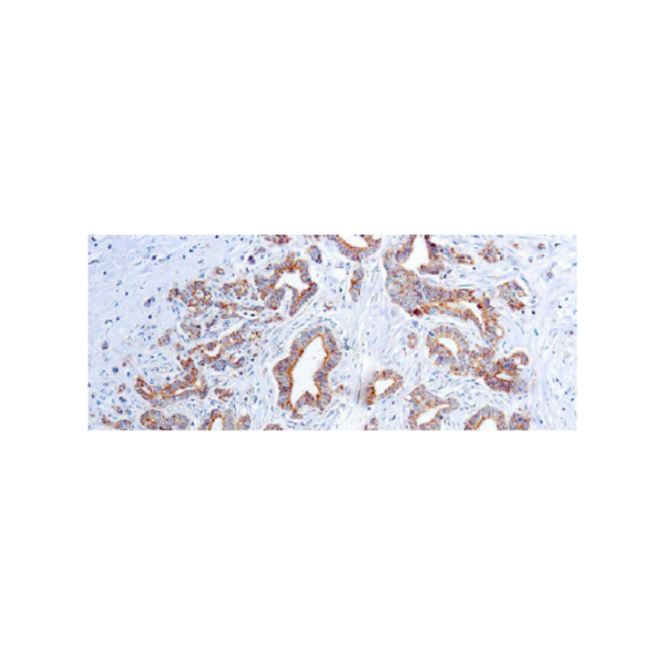 Factor de Crecimiento Endotelial Vascular (VEGF) (VG1)