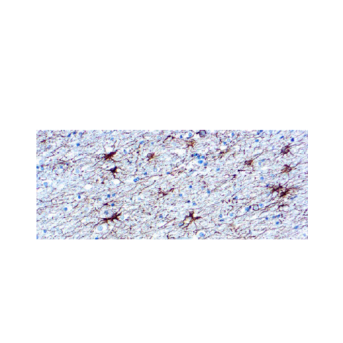 Glial Fibrillary Acidic Protein (GFAP)