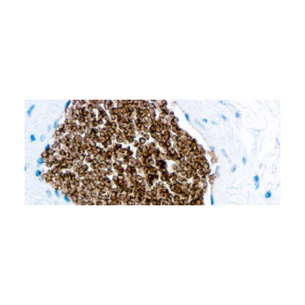 Glicoforina C