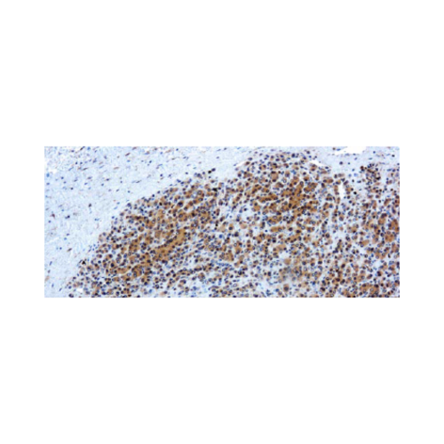 Glypican-3