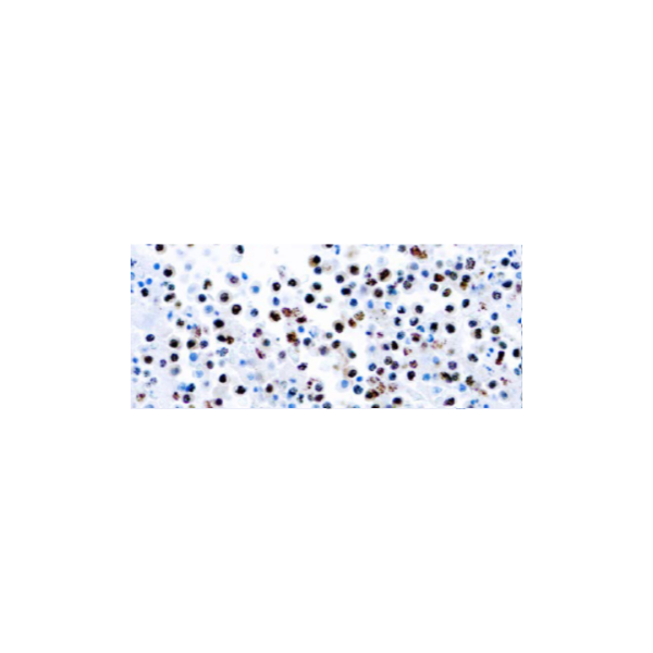 Herpesvirus 8 (HHV8)