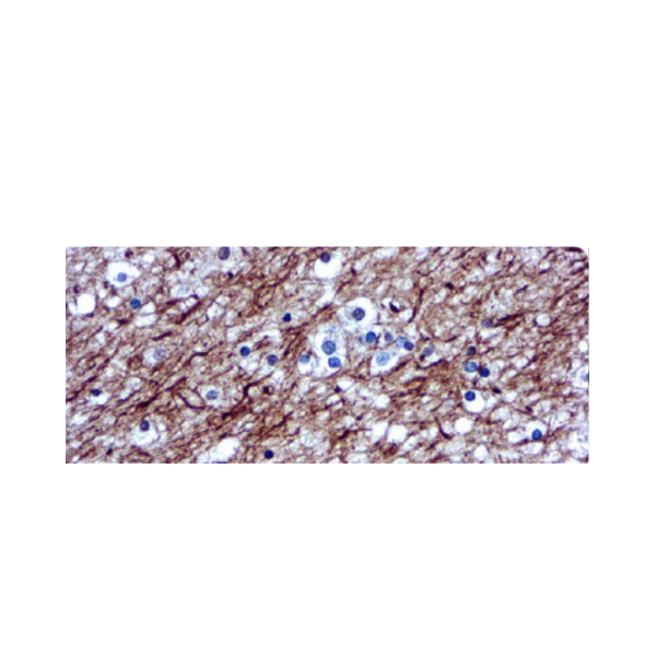 Neurofilamentos