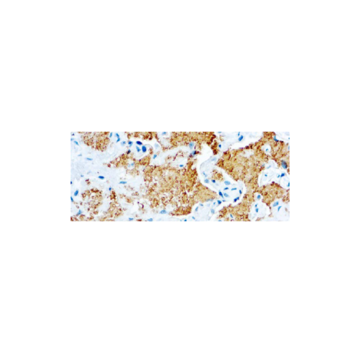 Pneumocystis