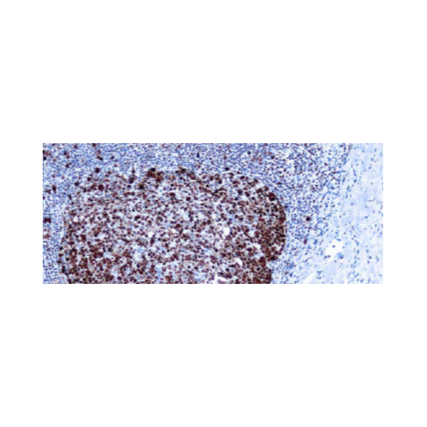 Proliferating Cell Nuclear Antigen (PCNA) (PC10)