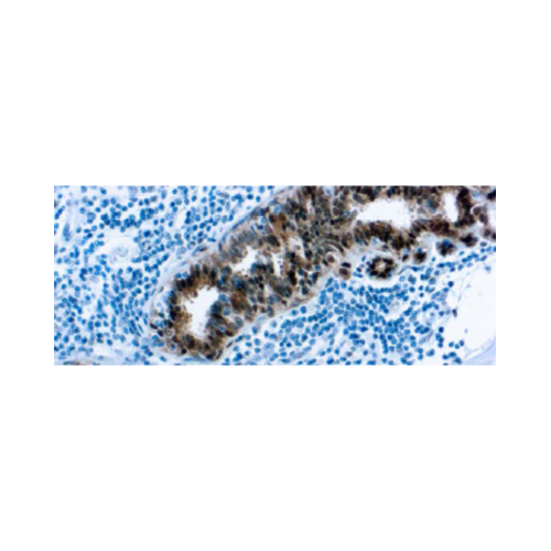 Proteína de Choque Térmico 70 (HSP 70) (W27)