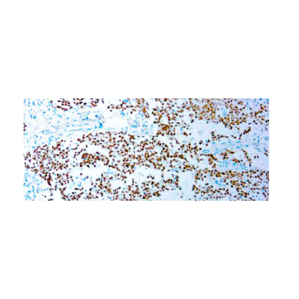 SALL4 (6E3)