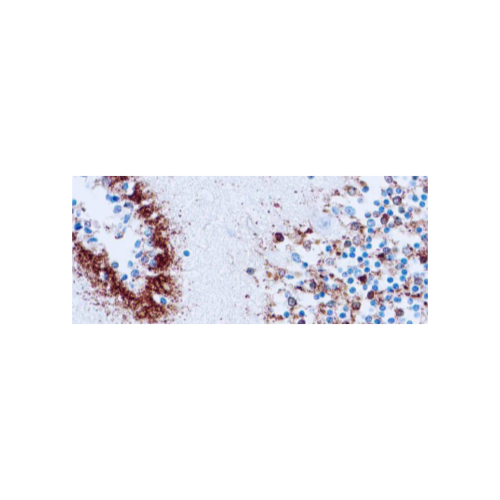 Tau (Neurofibrillary Tangles Marker)