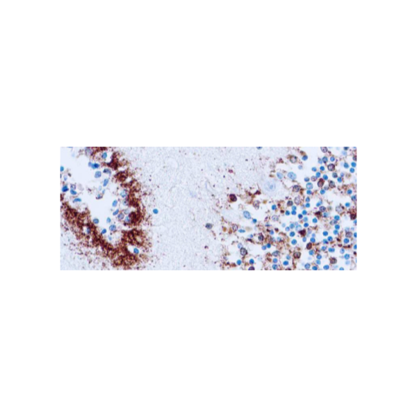 Tau (Neurofibrillary Tangles Marker) Tau (Neurofibrillary Tangles Marker)