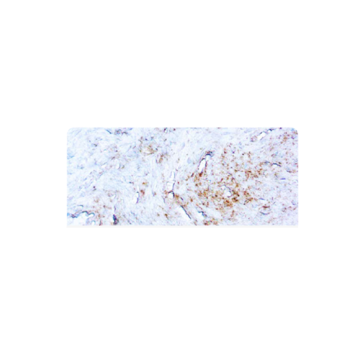 Treponema