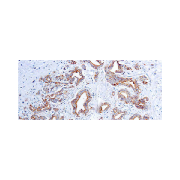 Vascular Endothelial Growth Factor Vascular Endothelial Growth Factor