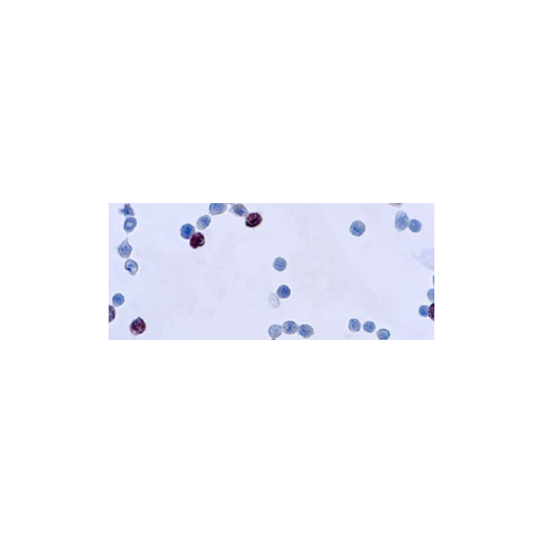 adenovirus