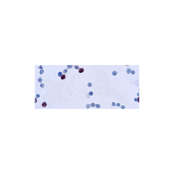 adenovirus