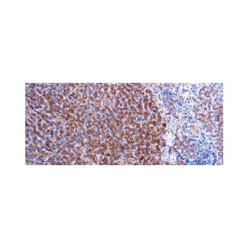 α-1-Antitrypsin