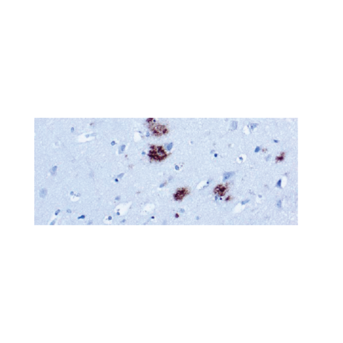 β-Amyloid Protein