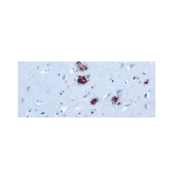 β-Amyloid Protein
