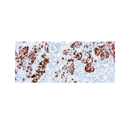 Adrenor Ticotropic Hormona