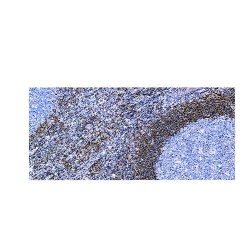 Bcl-2 Onco Proteina
