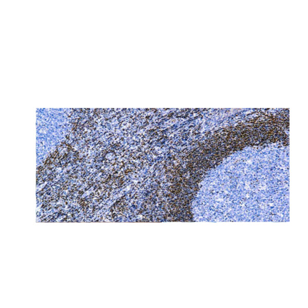 Bcl-2 Onco Proteina Bcl-2 Onco Proteina
