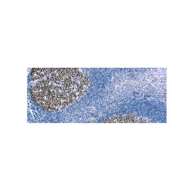 Bcl-6 (PG-B6)