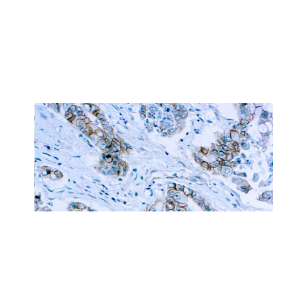 Beta-Catenin
