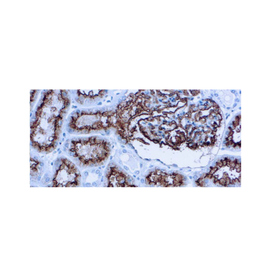 CD10 (CALLA)