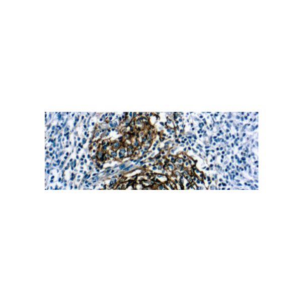 CD21, B cell (1F8) CD21, B cell (1F8)