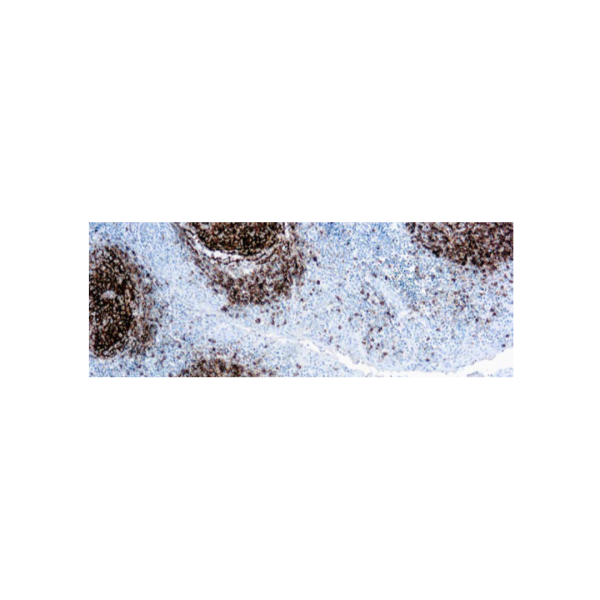 CD23 (1 B12)