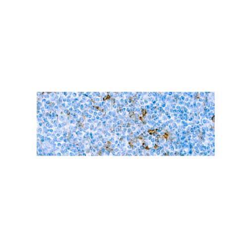 CD25IL‐2R α