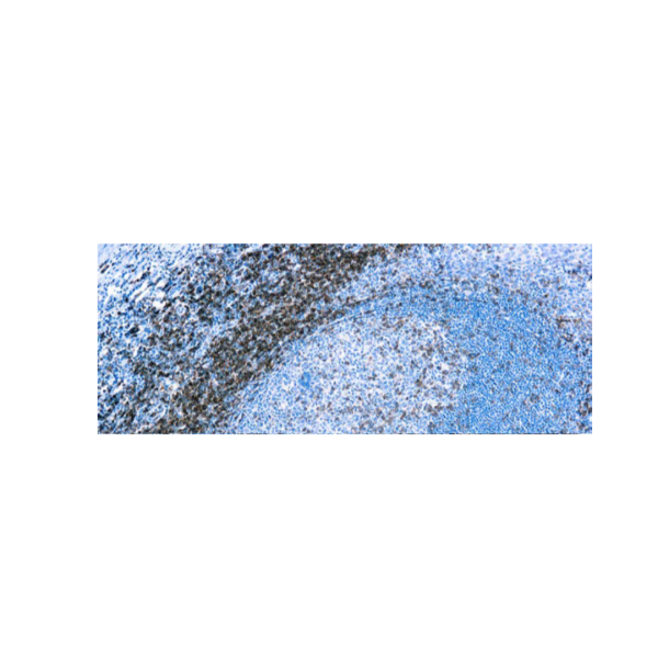 CD4 (EP204)