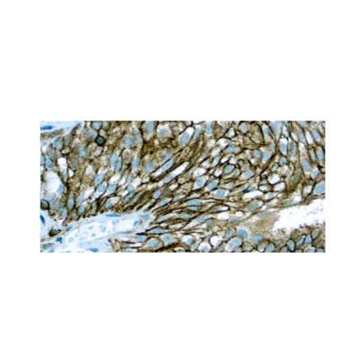 CD44HCAM