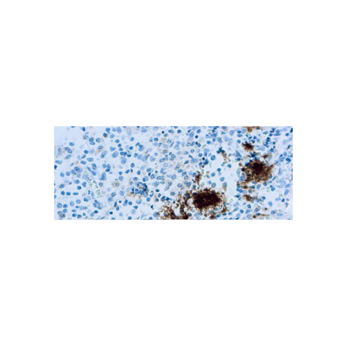 CD61Glycoprotein IIIa plaquetas