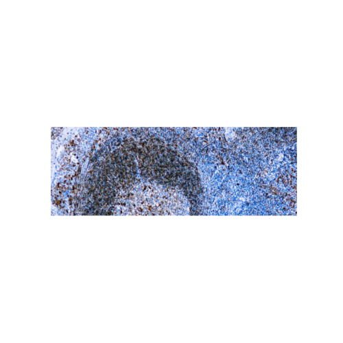 CD79a, B Cell (HM57) CD79a, B Cell (HM57)