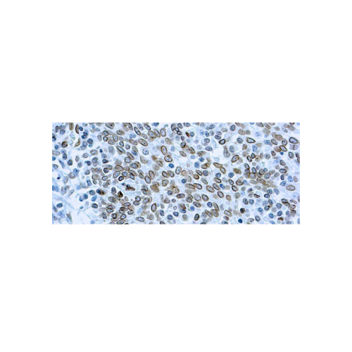 Cdc25A