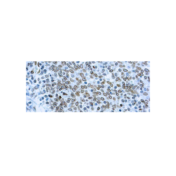 Cdc25A Cdc25A