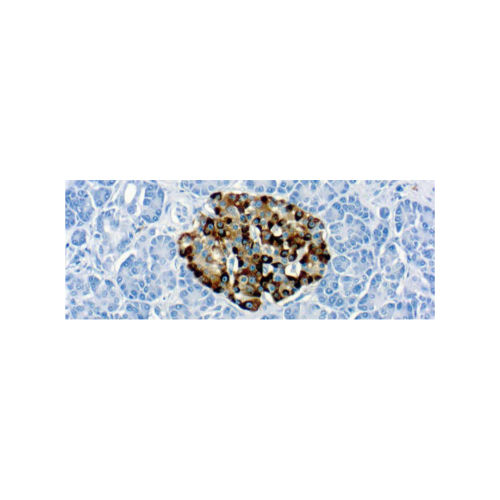 Chromogranin