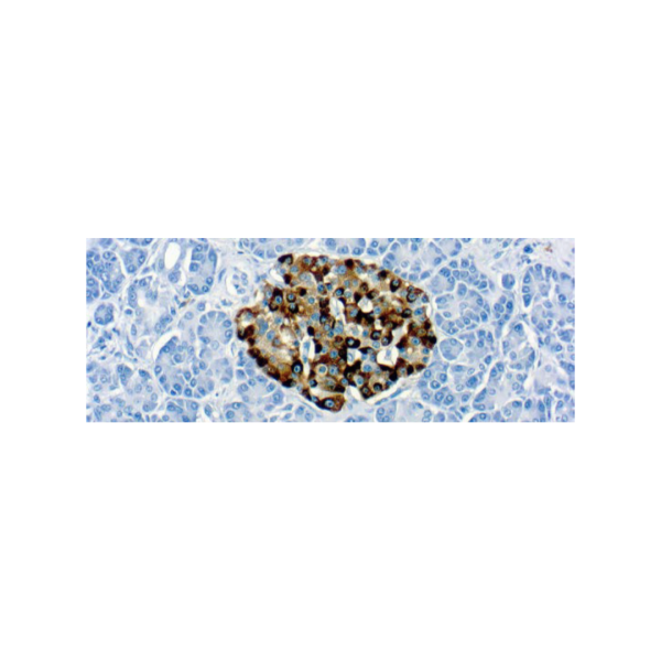 Chromogranin Chromogranin