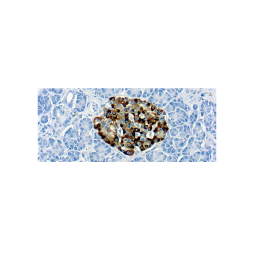 Diagnostic BioSystems 6616 Owens Drive Pleasanton, CA, 94588 Tel: (925) 484 3350 www.dbiosys.com Emergo Europe Prinsessegracht 20 2514 AP, The Hague The Netherlands Tel: (31) (0) 70 345 8570 Chromogranin A (LK2H10)