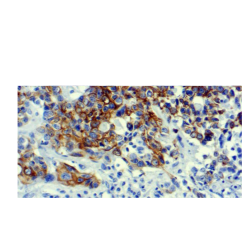 Cytokeratin 7 (LP1K)