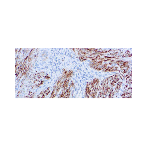 Desmina (D33)