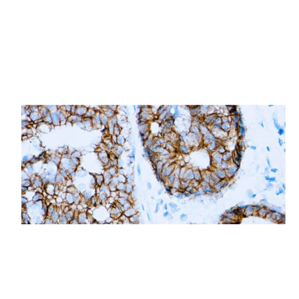 E-Cadherin (SPM471)