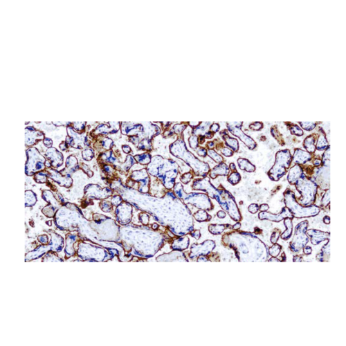 (EGFR) -31G7