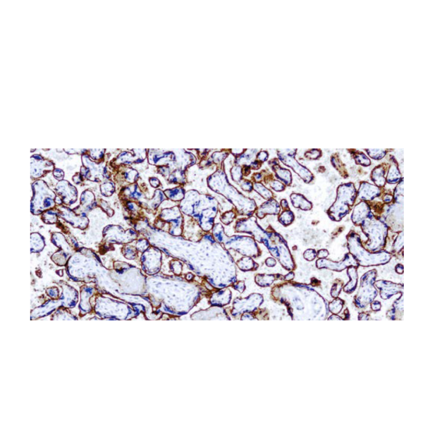 (EGFR) -31G7